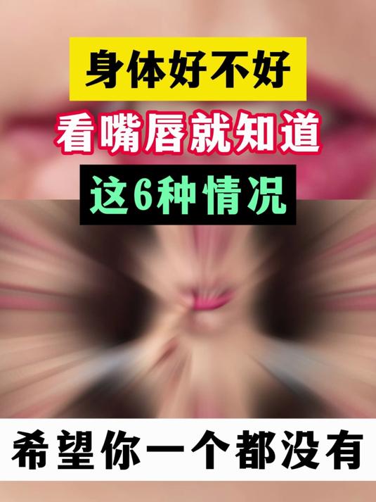 身体好不好 看嘴唇就知道这6种情况 希望你一个都没有