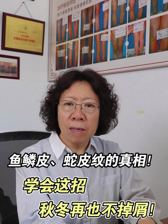 鱼鳞皮蛇皮纹的真相!学会这招,秋冬再也不掉屑!