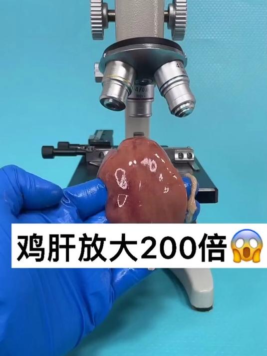鸡肝真的卫生吗……