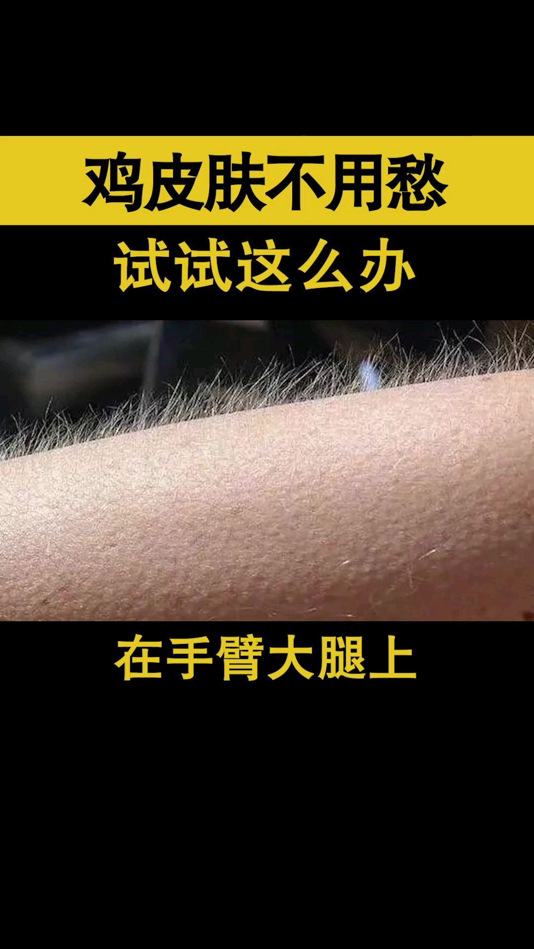 毛周角化症=鸡皮肤