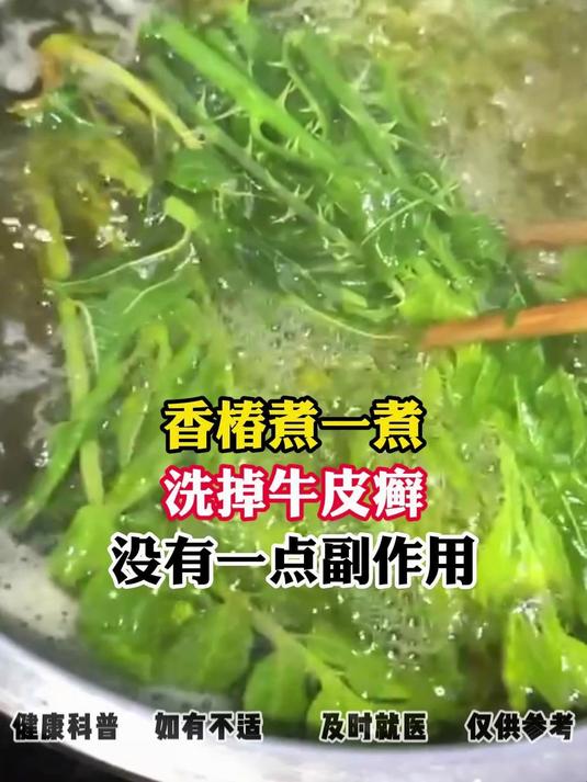 香椿煮一煮,洗掉牛皮癣,没有一点副作用