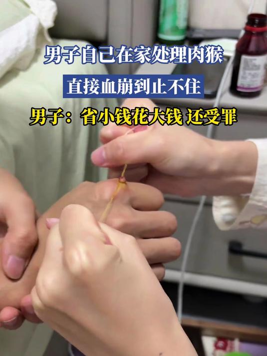 男子自己在家处理肉猴,直接血崩到止不住