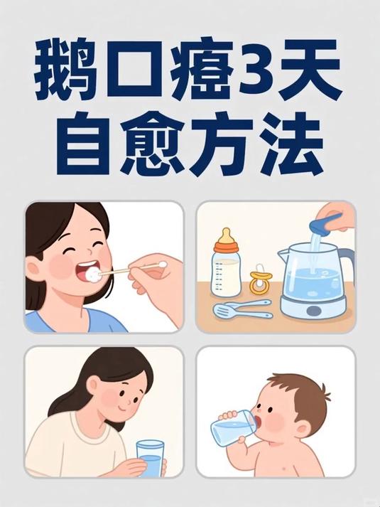 鹅口疮3天自愈方法