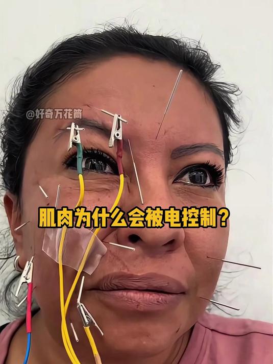 肌肉为什么会被电控制？