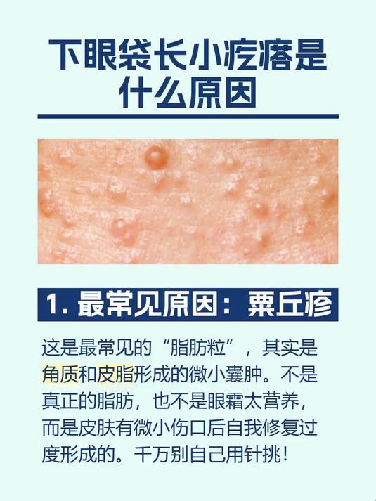 #马上健康过大年#下眼袋长小疙瘩是什么原因
