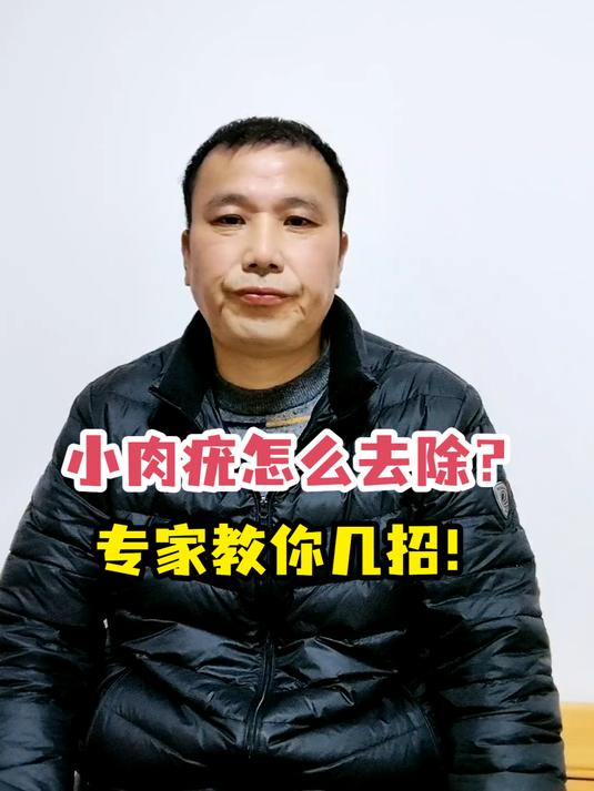 小肉疣怎么去除?专家教你几招!