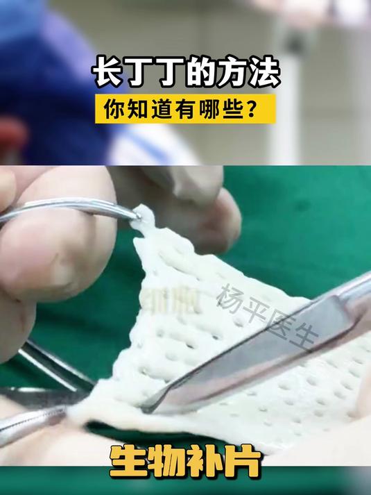 长丁丁的方法,你知道有哪些?