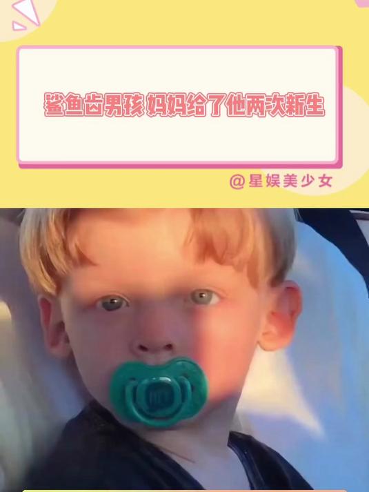 鲨鱼齿男孩 妈妈给了他两次新生