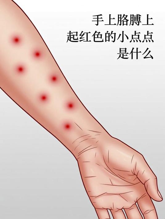 手上胳膊上起红色的小点点是什么 #健康扬帆季#