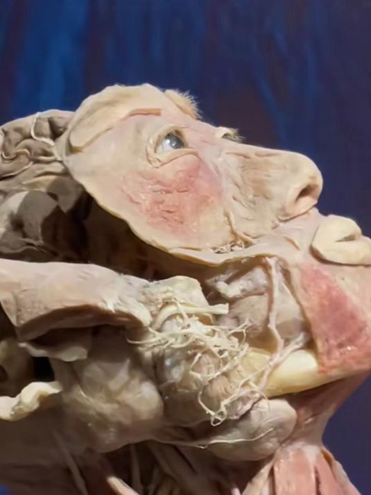 真实的大体老师!面部肌肉一旦破坏无法恢复