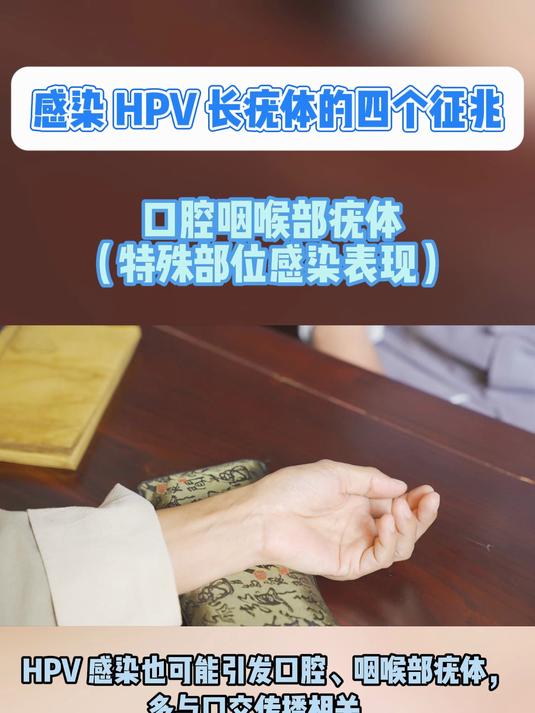 感染 HPV 长疣体的四个征兆 - 口腔咽喉部疣体