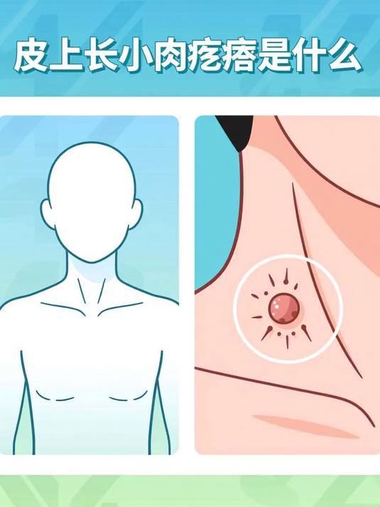 皮上长小肉疙瘩是什么