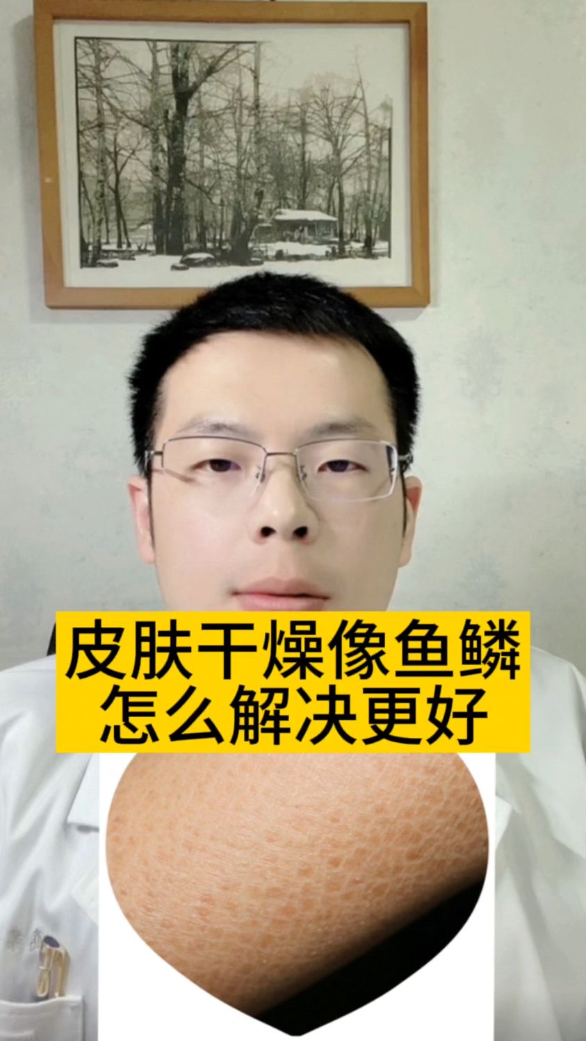 皮肤干燥像鱼鳞这个方法帮到你!