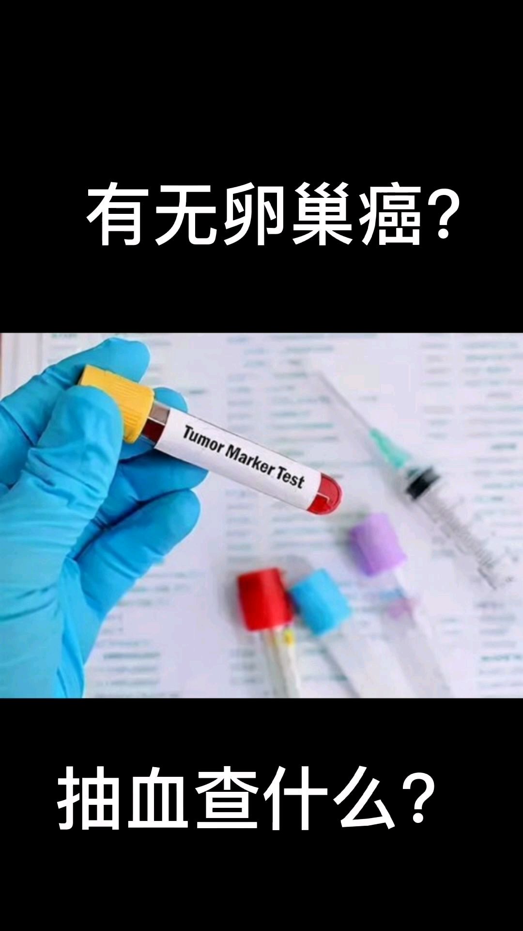 有无卵巢癌?抽血化验告诉你