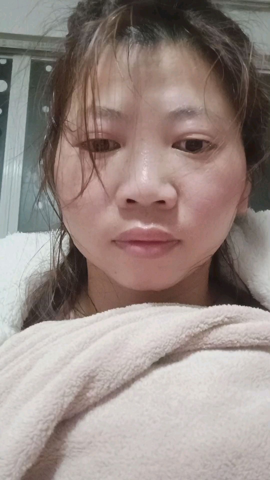 脸部胸部熏蒸中!## 乳腺结节3类调理中