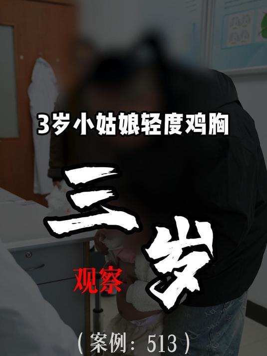 3岁小女孩轻度鸡胸,不用太早干预,勤观察,5岁以后再看