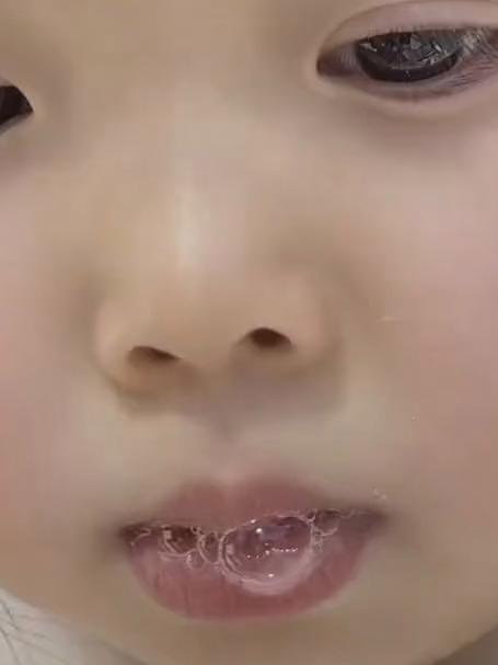 当小孩姐第一次戴上牙套,好像小金鱼吐泡泡啊!