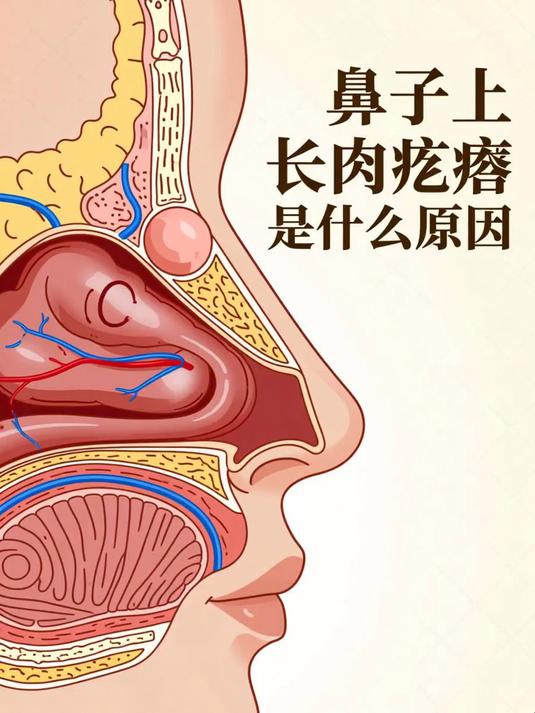 鼻子上长肉疙瘩是什么原因