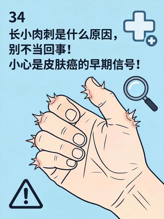 长小肉刺是什么原因,别不当回事!小心是皮肤癌的早期信号!(1)