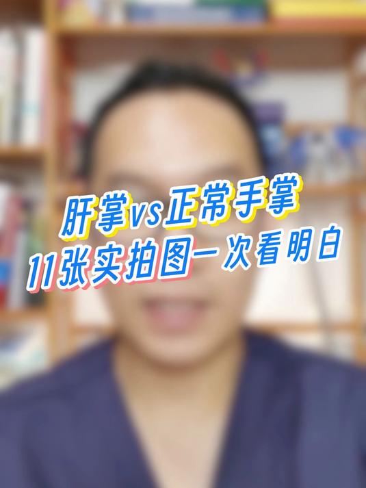 肝掌 vs 正常手掌,11 张图教你一次看懂