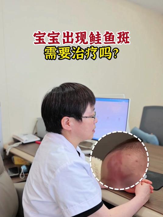 宝宝出现鲑鱼斑，需要治疗吗？