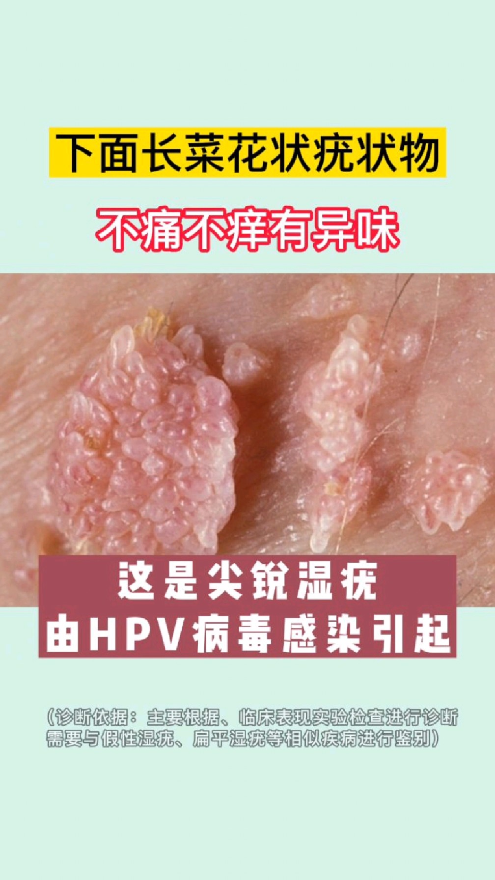 不要太过“放纵”自己,远离不洁X行为。