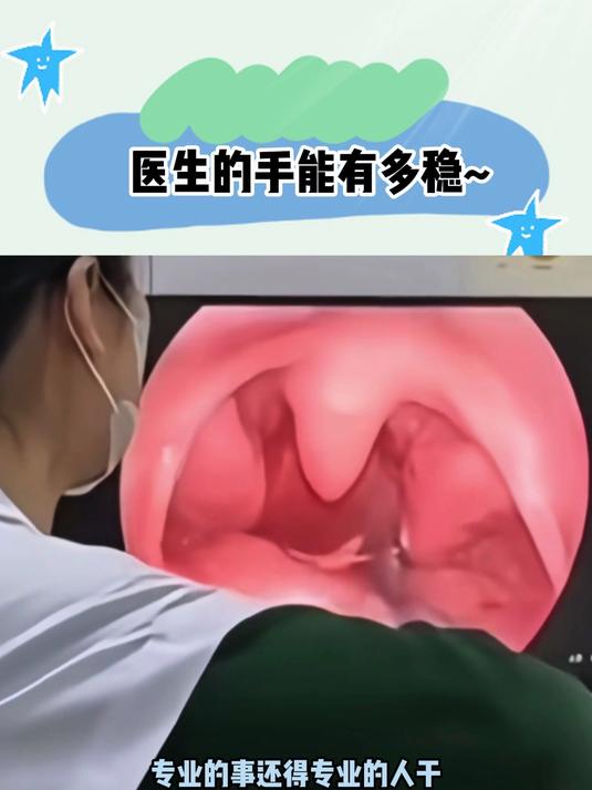 本来之前觉得100块拔根鱼刺还有些贵,现在看来划算的