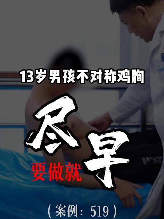 13岁不对称鸡胸,要做就尽早,对健康没影响,要不就不管