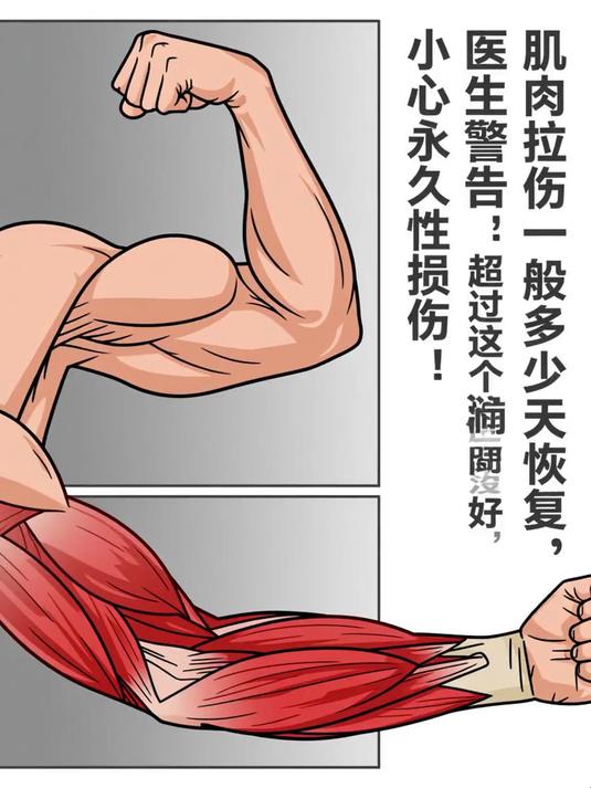 肌肉拉伤一般多少天恢复,医生警告:超过这个时间没好,小心永久性损伤!#健康扬帆季#
