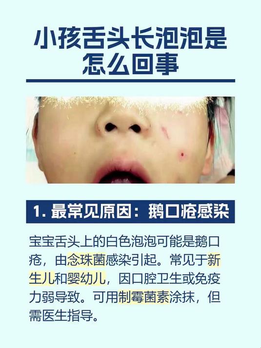 小孩舌头长泡泡是怎么回事
