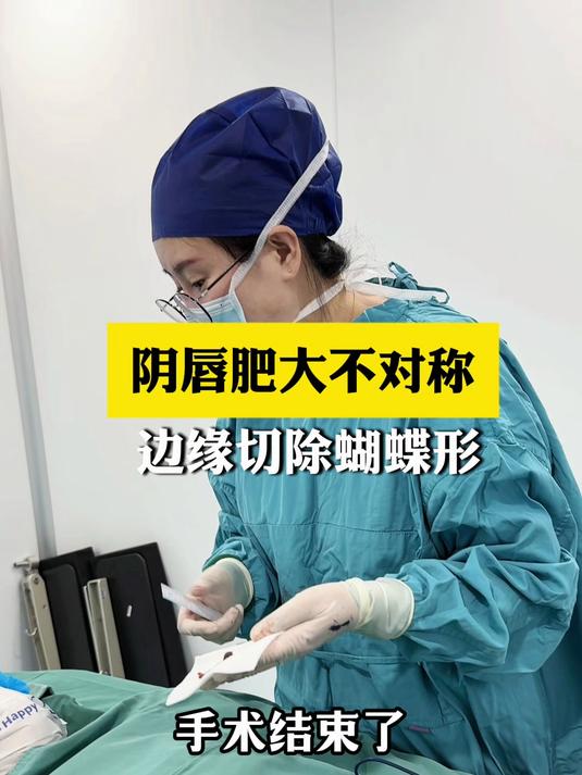 阴唇肥大不对称 边缘切除蝴蝶形