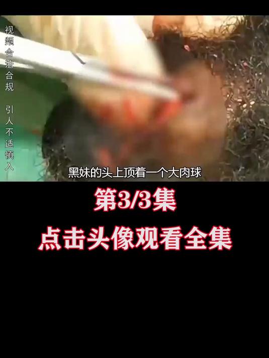 黑妹头上顶着大肉球,硬邦邦的感觉敲不碎,划开后直接喷出