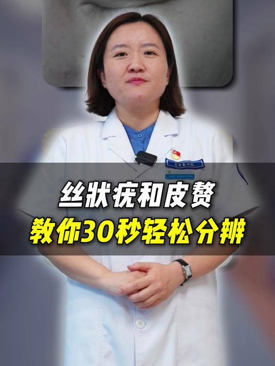 丝状疣和皮赘教你30秒轻松分辨