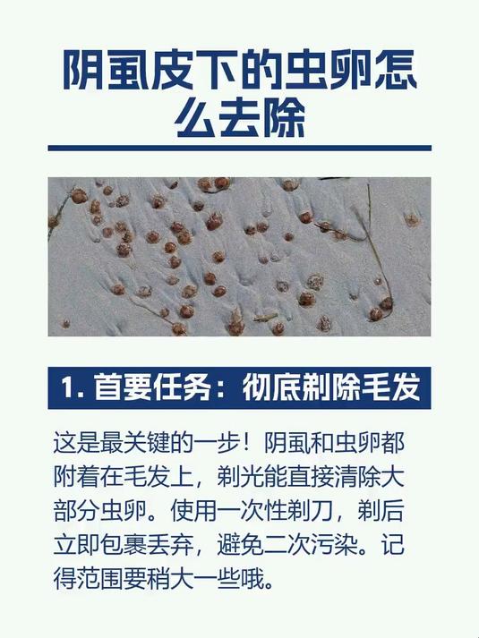 阴虱皮下的虫卵怎么去除