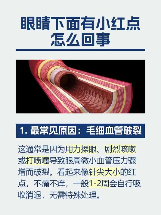 眼睛下面有小红点怎么回事