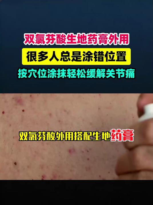 双氯芬酸外用搭配生地药膏，很多人用错位置？这样正确缓解关节痛 #扬帆养生季#