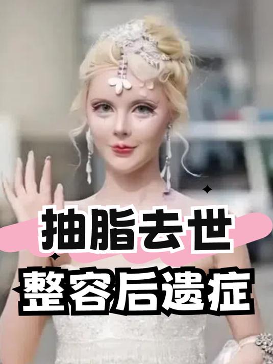 刘大美丽抽脂去世,迪丽拉吃饭张不开嘴,才明白整容后遗症多明显