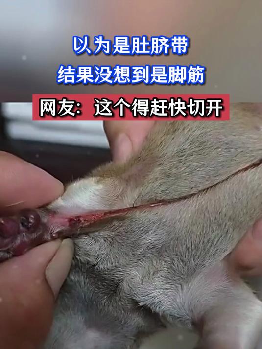 以为是肚脐带,结果没想到是脚筋,网友:这个得赶快切开