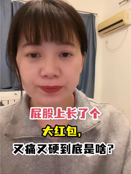 屁股上长了个大红包,又痛又硬到底是啥?