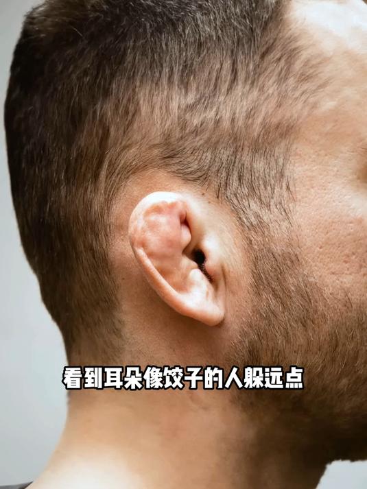为啥要远离有饺子耳的人呢？看完你就知道了！