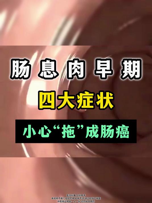 肠息肉早期四大症状