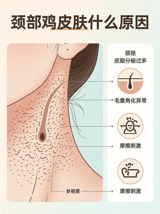 颈部鸡皮肤什么原因