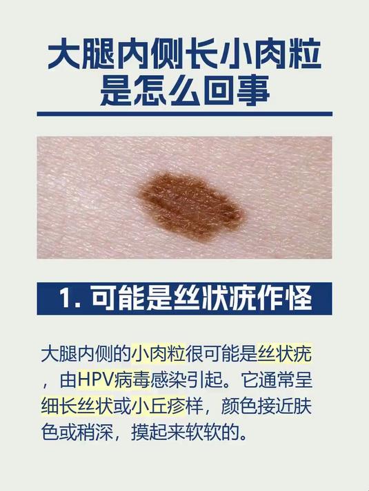 大腿内侧长小肉粒是怎么回事