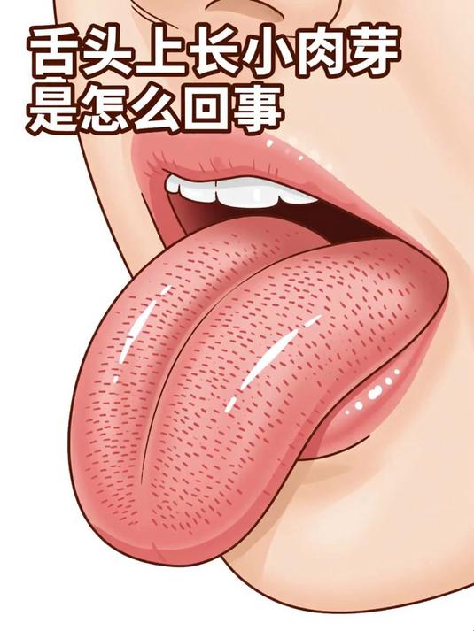 舌头上长小肉芽是怎么回事 #健康扬帆季#