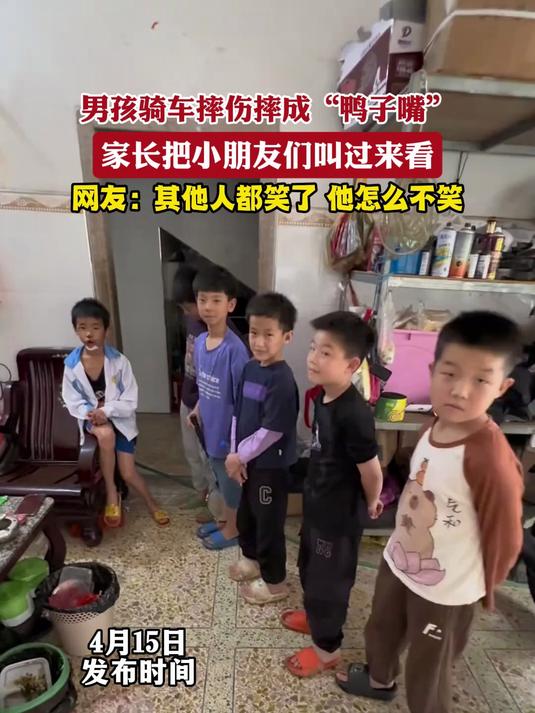 男孩骑车摔伤摔成“鸭子嘴”,家长把小朋友们叫过来看