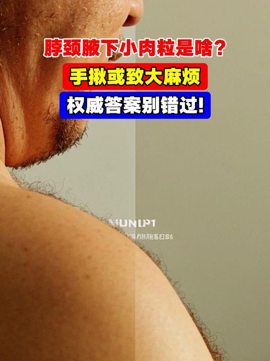 脖颈腋下小肉粒是啥?手揪或致大麻烦,权威答案别错过!