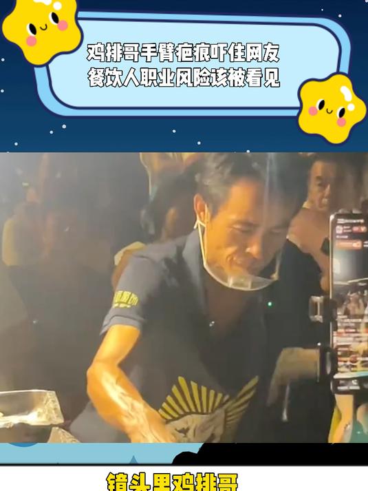 鸡排哥手臂疤痕吓住网友,餐饮人职业风险该被看见