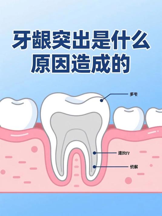 牙龈突出是什么原因造成的