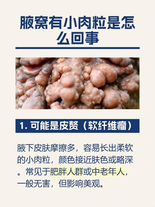 腋窝有小肉粒是怎么回事