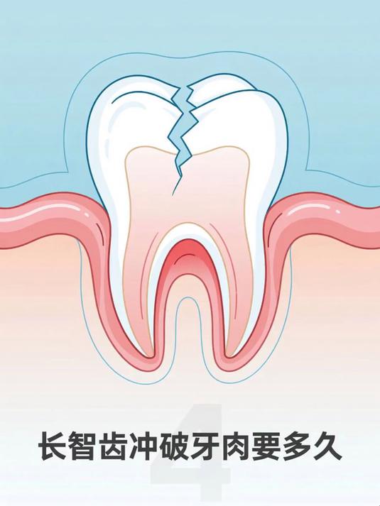 长智齿冲破牙肉要多久